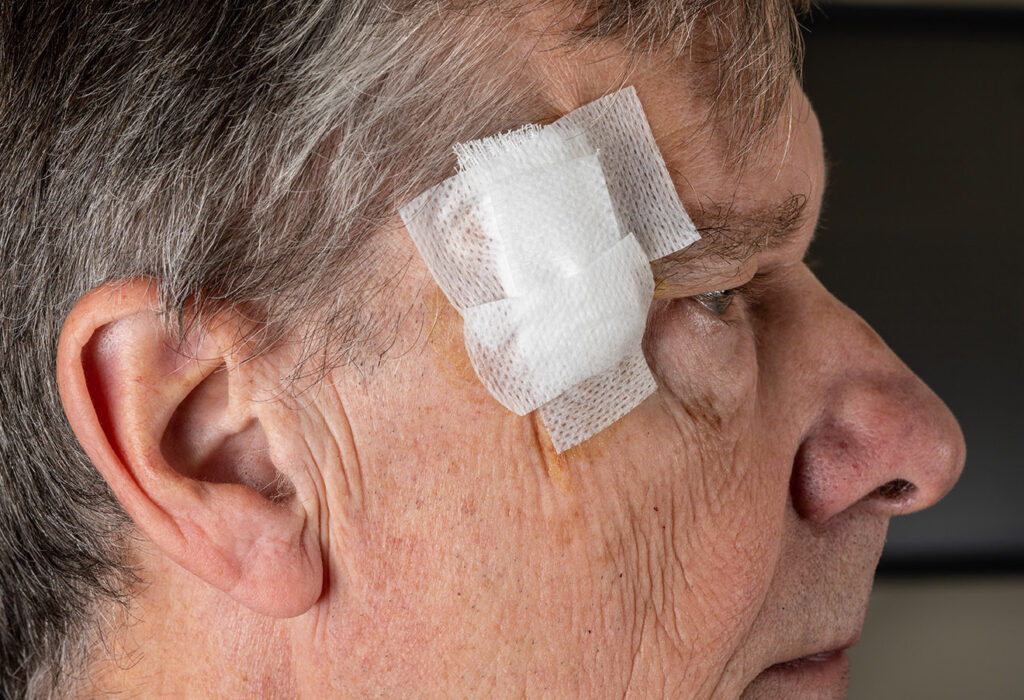 Side view of senior man after MOHS surgery to remove skin cancer with dressings - Welcome to DMSI - Professional Surgical Dermatology Services | Dermatology